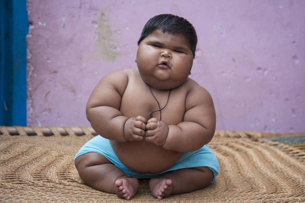 No Web until 15 March - Exclusive - 10-month-old Aliya Saleem plays with her necklace on February 18, 2015 in Shamli, India.A 10-month-old baby in India has weighed in at an astonishing 18.7kg (2st 13lbs) - the weight of an average six-year-old girl. Baby Aliya, whose parents live in a remote village in the Indian state of Jharkhand, was born at a relatively large 4kg (9lbs), but started rapidly piling on the pounds once she hit the four month mark. Her enormous weight has put her life in danger and placed a huge strain on the already limited finances of her parents, dad Mohammad Saleem and mum Shabana Parveen, who are struggling to cover the costs of her daily food intake and the regular need for new clothes. The family has until now been unable to afford to take her to a hospital, but were able to get a consultation at Fortis Hospital to see a specialist in a bid to get to the bottom of Aliya's condition. Photo by Arkaprava Ghosh/Barcroft India/ABACAPRESS.COM  | 489712_030 Shamli Inde India